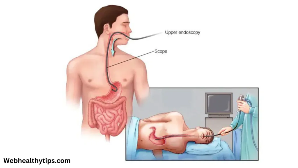 colonoscopy 